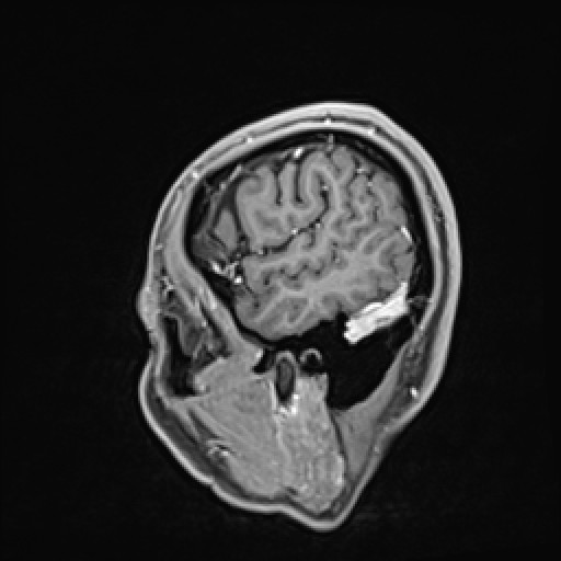 Click on the Serie image to view the images of VILLANUEVA, WILLIAM A.